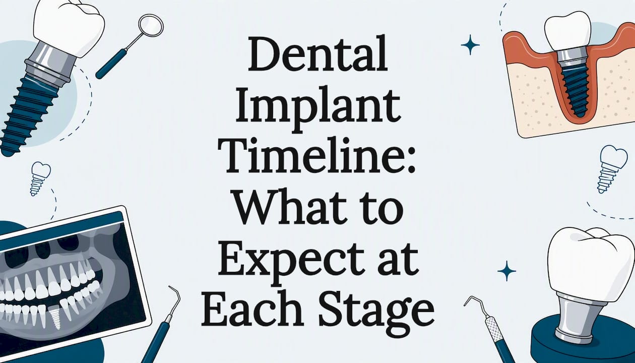 Decorative dental implant timeline title card