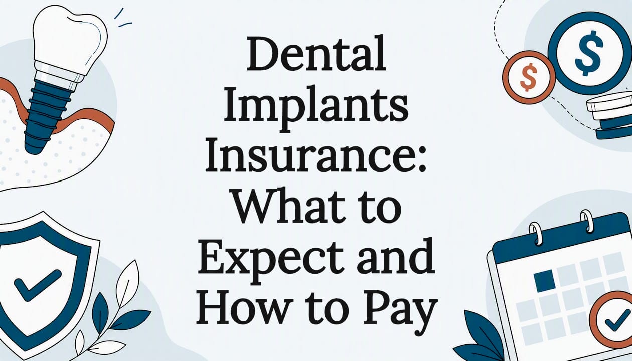 Decorative title card illustration for dental implants insurance article