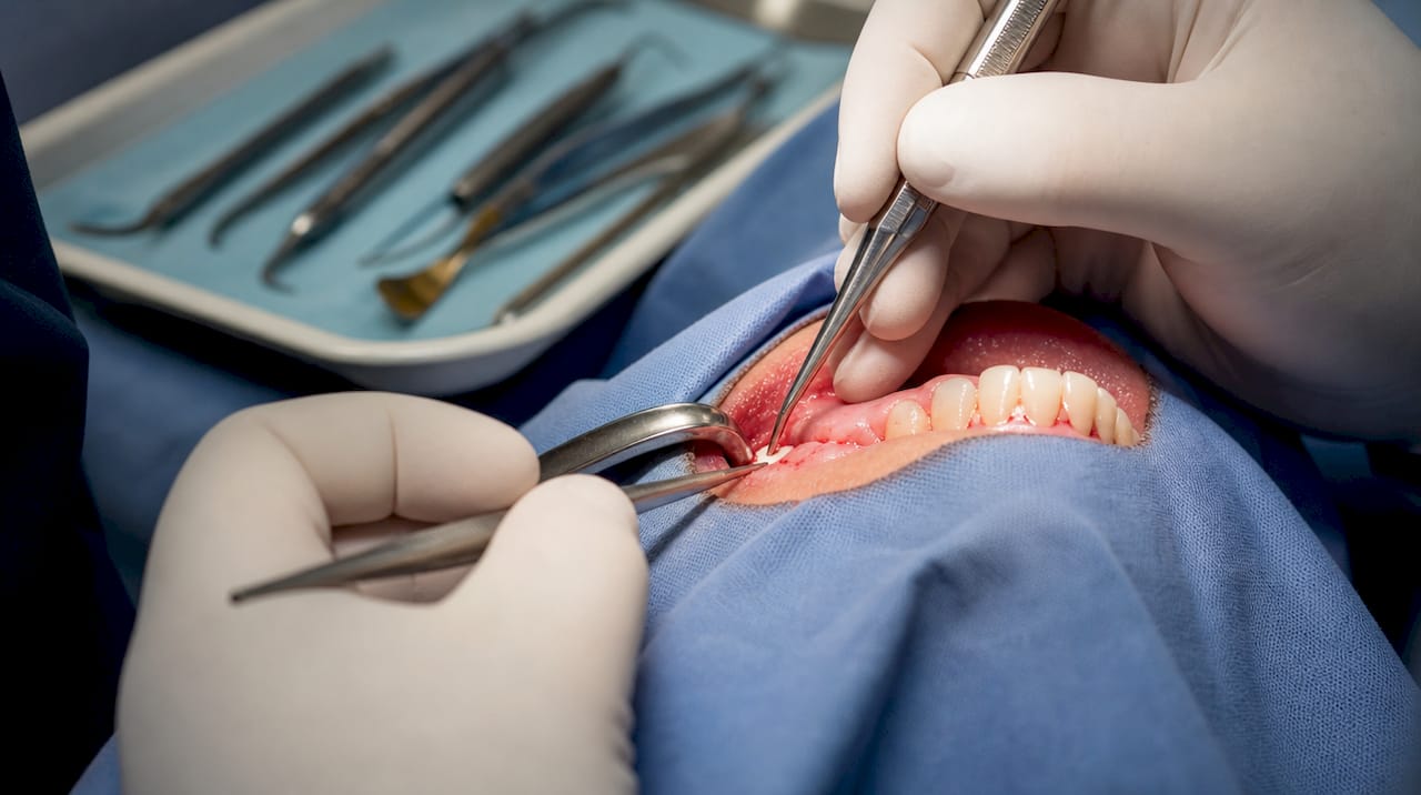 Surgeon’s hands performing gum graft surgery