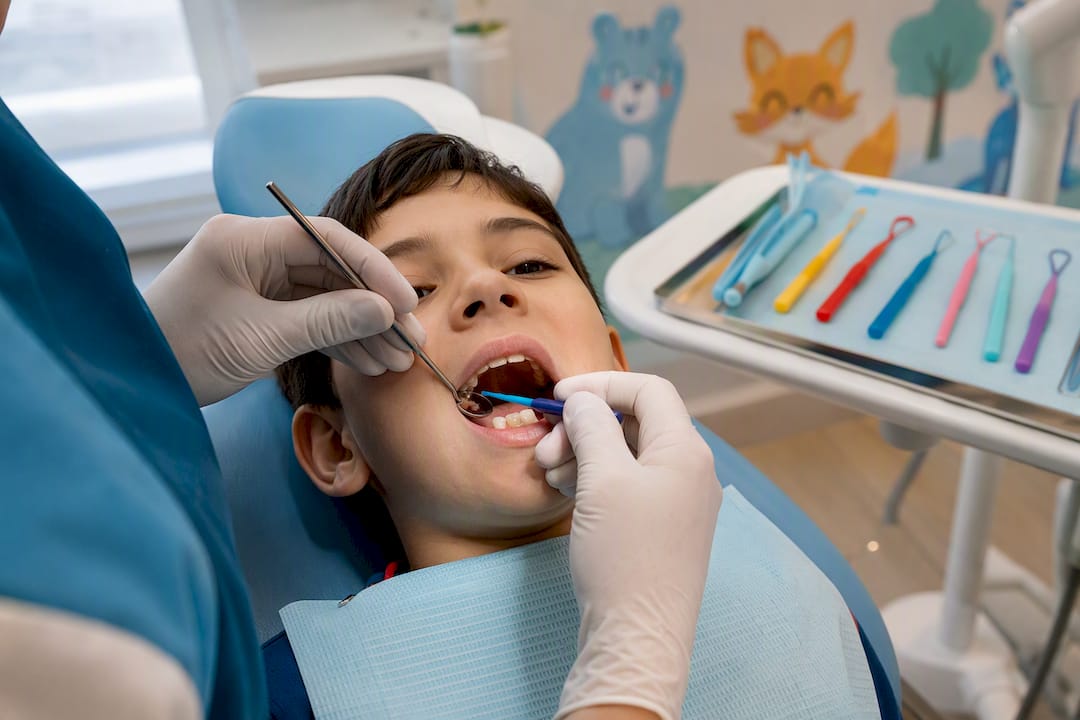 Dentist applying dental sealant to molar