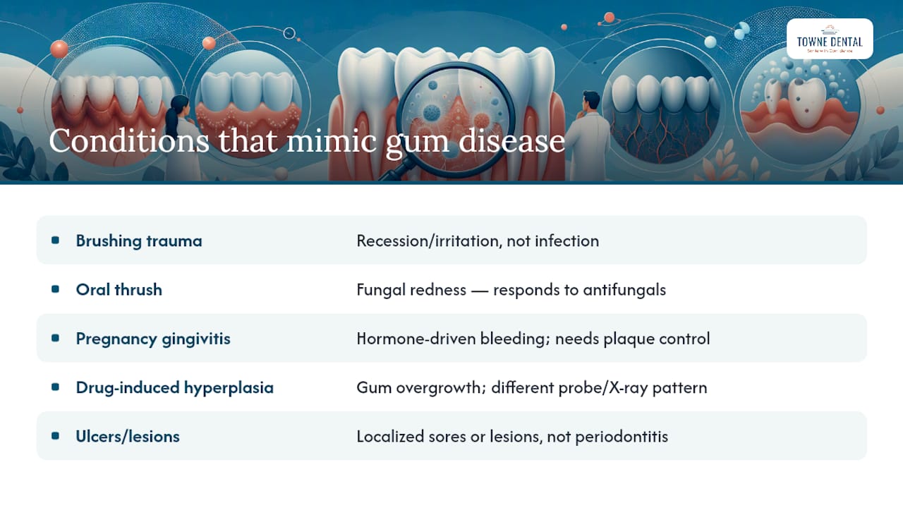 Which Other Conditions Look Like Gum Disease? — overview diagram